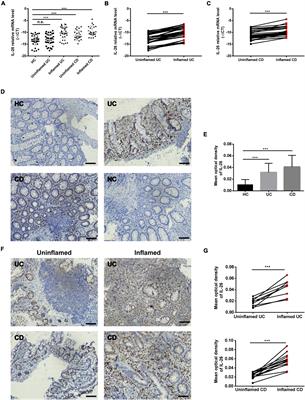 Interleukin-26 Expression in Inflammatory Bowel Disease and Its Immunoregulatory Effects on Macrophages